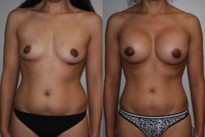 Before and After Image