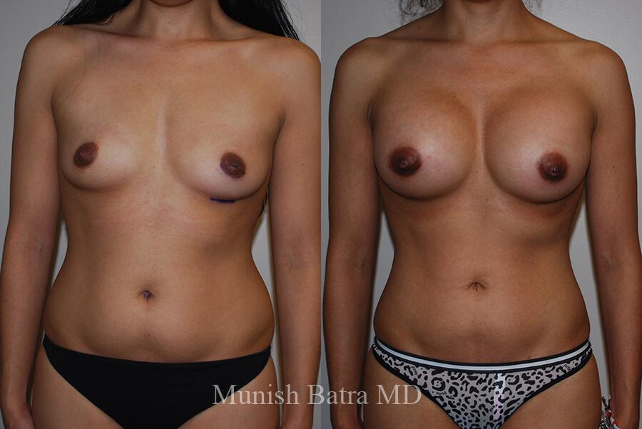 Before and After Image