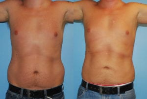 Before and After Image