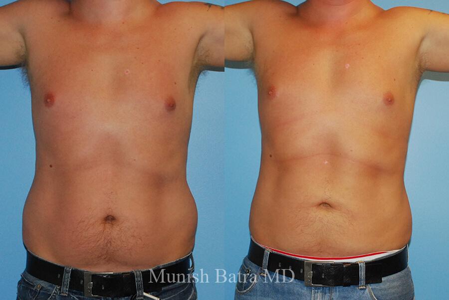 Before and After Image
