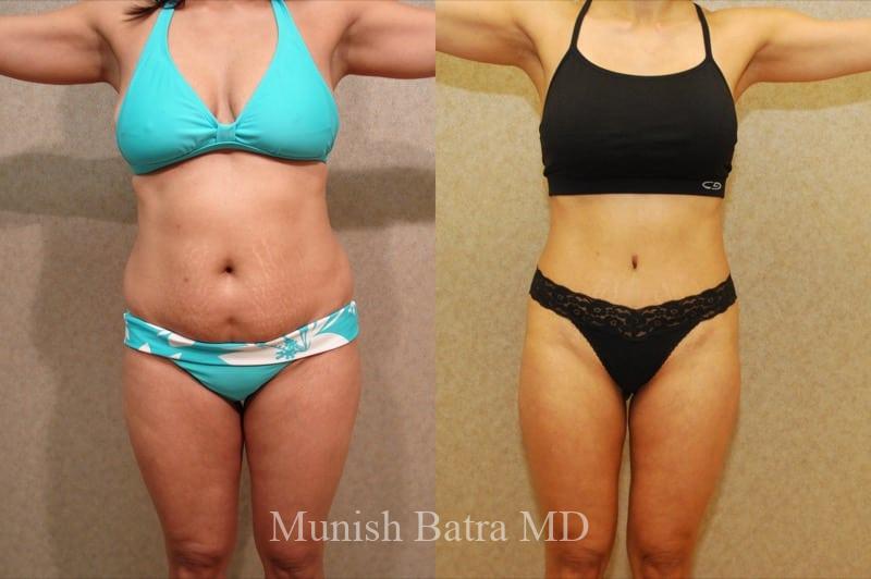 Before and After Image
