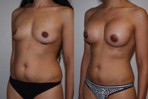 Before and After Image