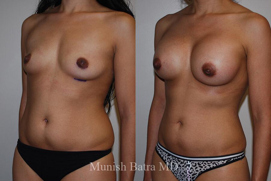 Before and After Image