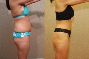 Before and After Image