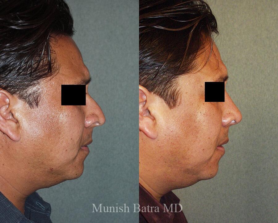Before and After Image