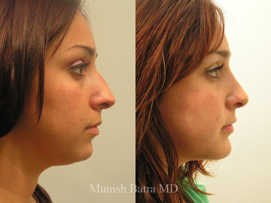Before and After Image