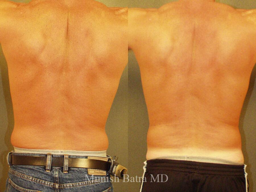 Before and After Image