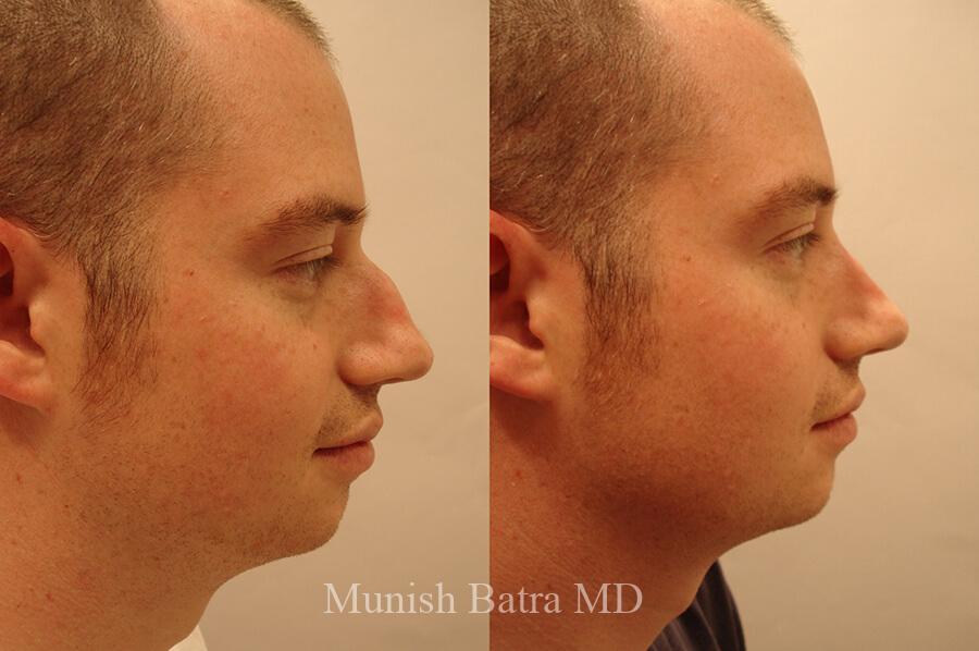 Before and After Image