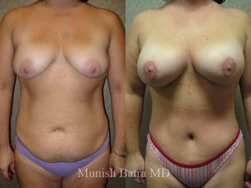 Before and After Image