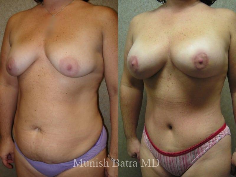 Before and After Image
