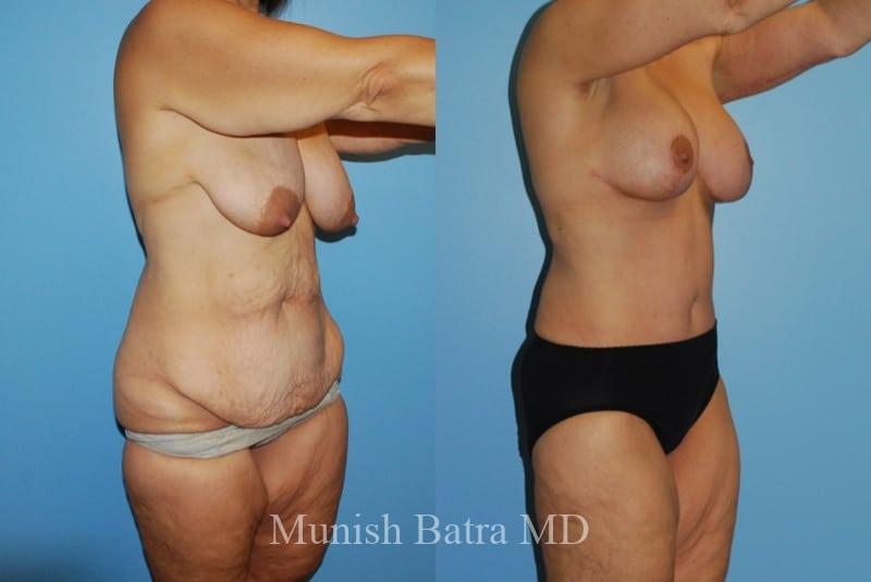 Before and After Image