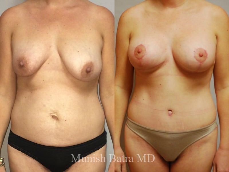 Before and After Image