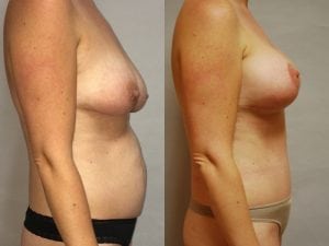 Before and After Image