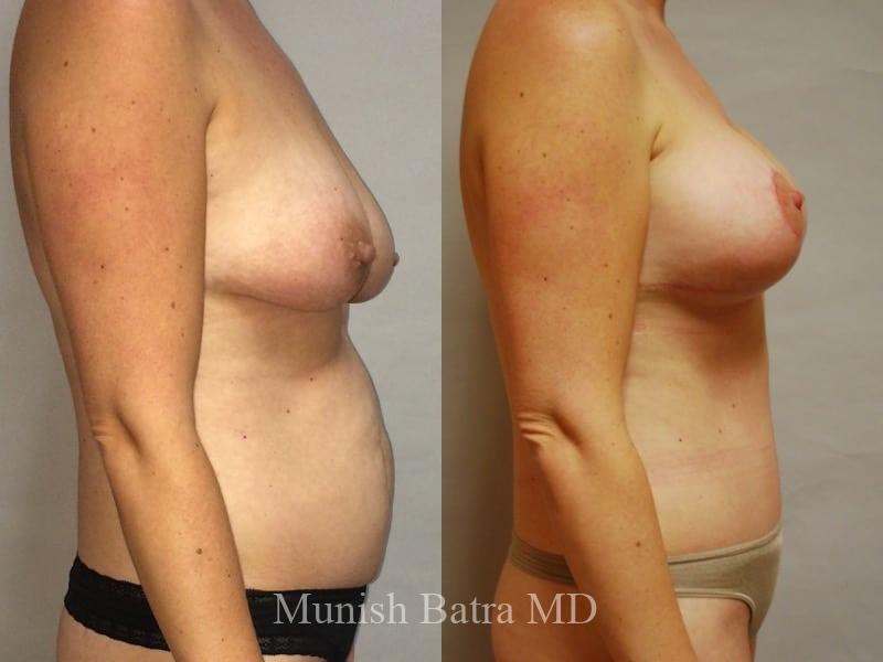Before and After Image