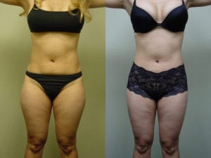 Before and After Image