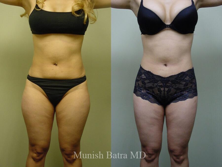 Before and After Image