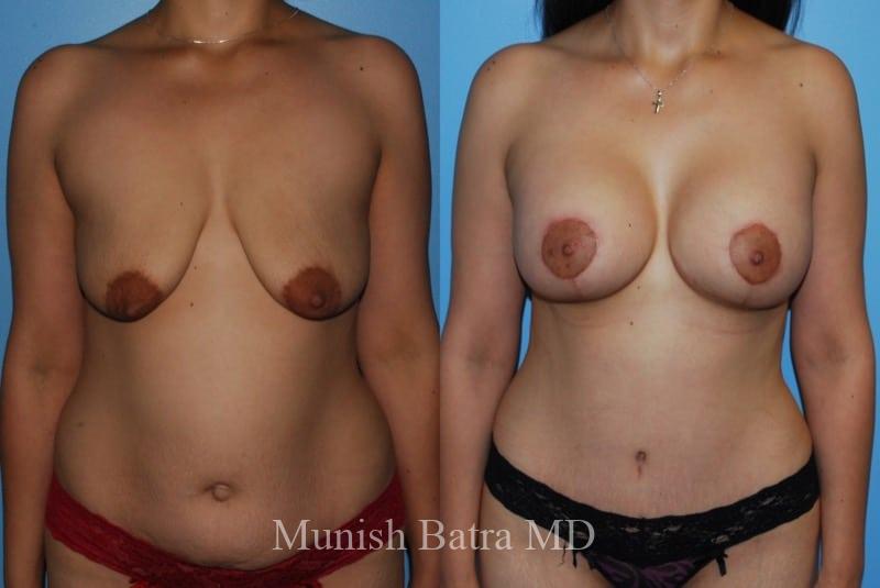 Before and After Image