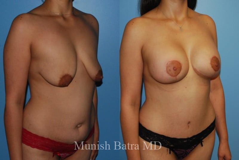 Before and After Image