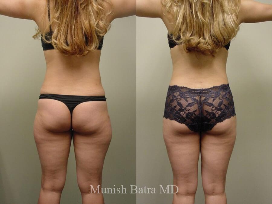 Before and After Image