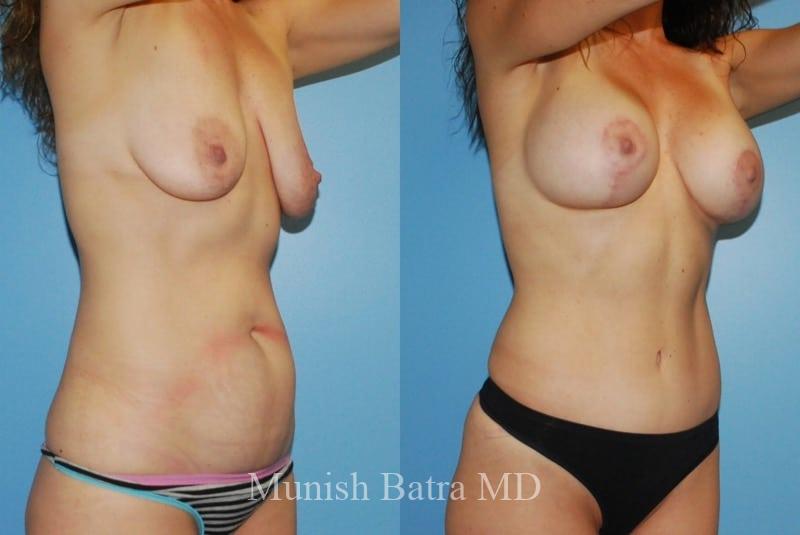Before and After Image