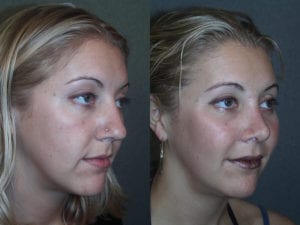 Before and After Image