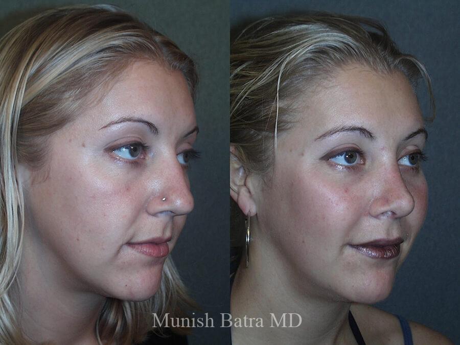 Before and After Image