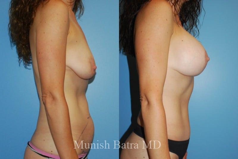 Before and After Image