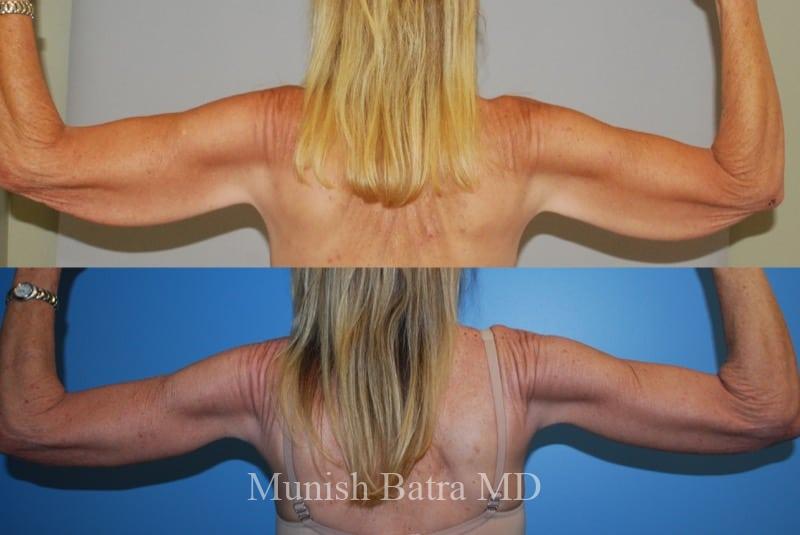 Before and After Image