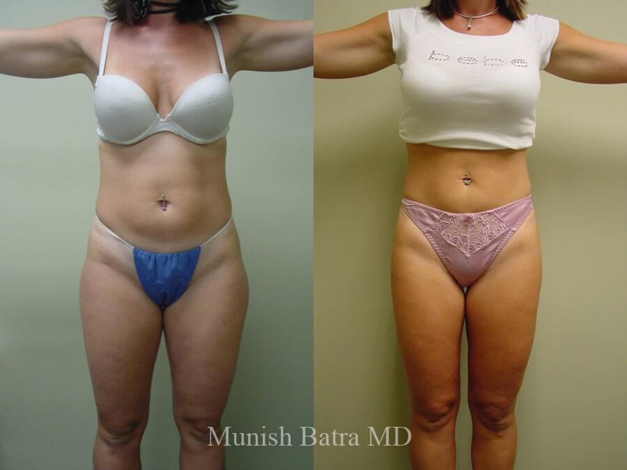 Before and After Image