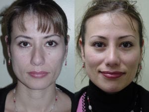 Before and After Image