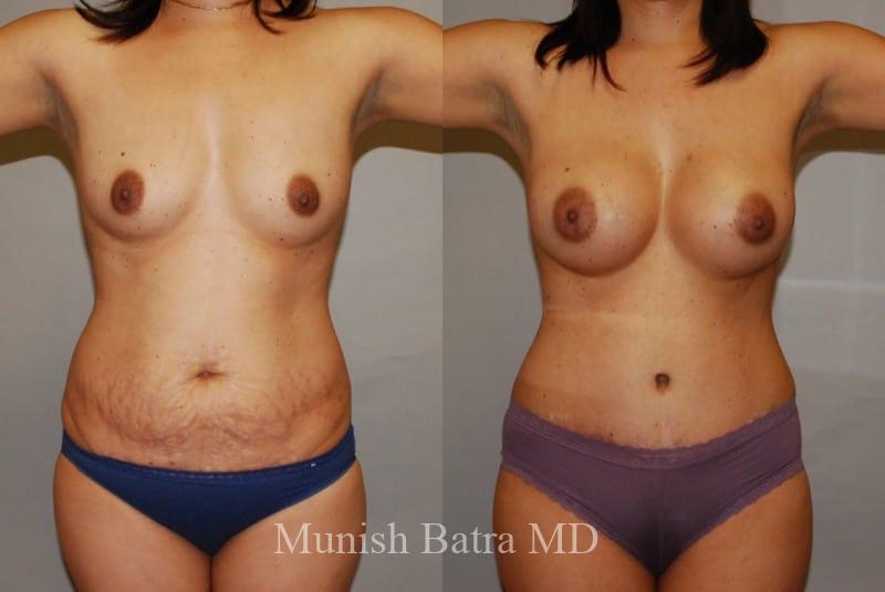 Before and After Image