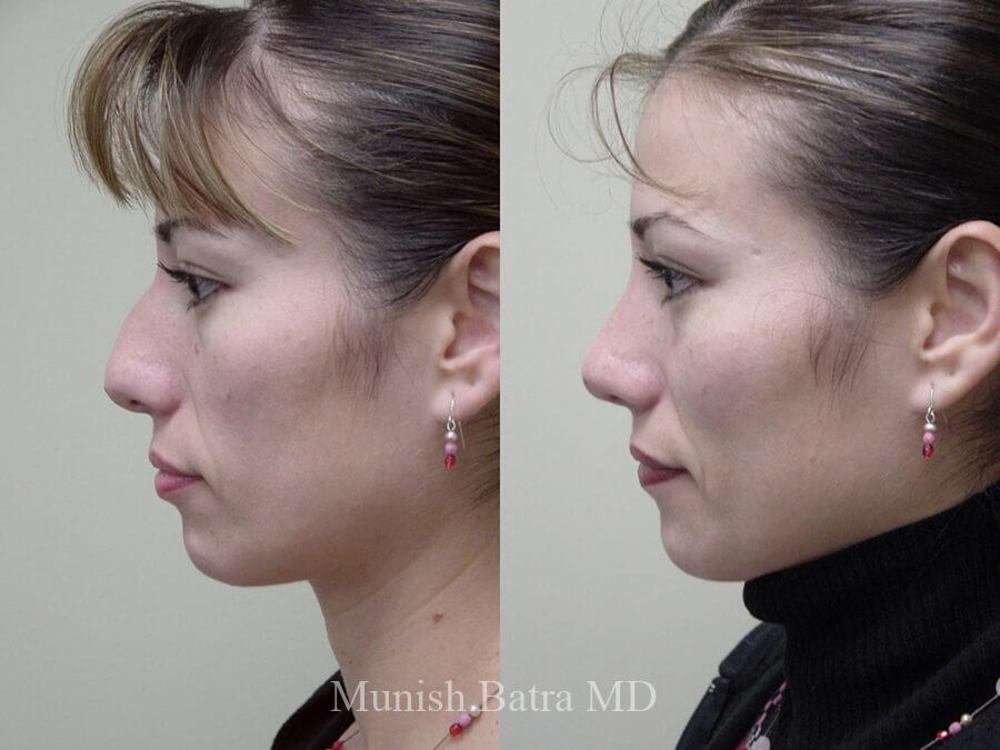 Before and After Image