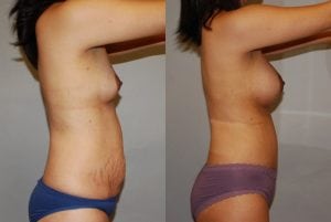 Before and After Image