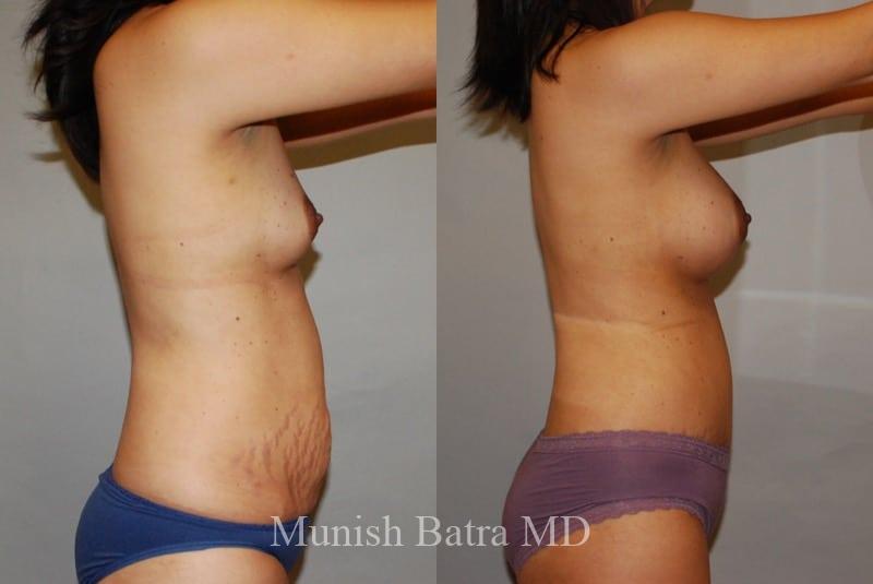 Before and After Image