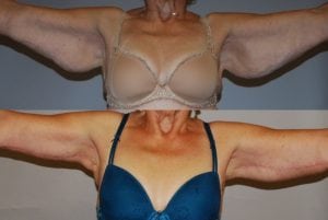 Before and After Image