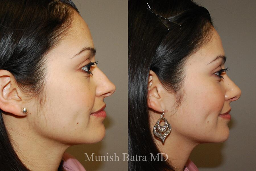 Before and After Image