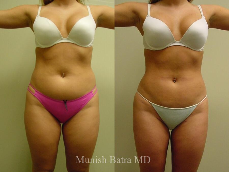 Before and After Image