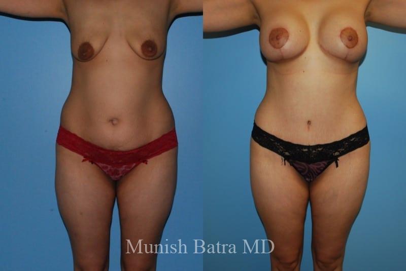 Before and After Image