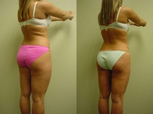 Before and After Image