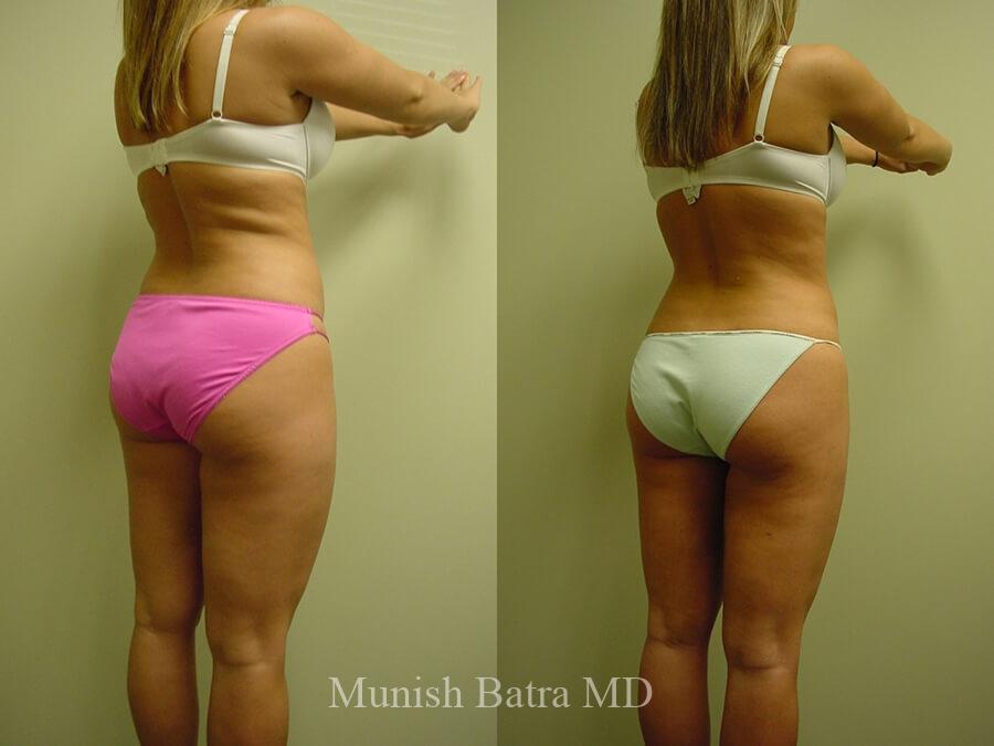Before and After Image