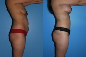 Before and After Image