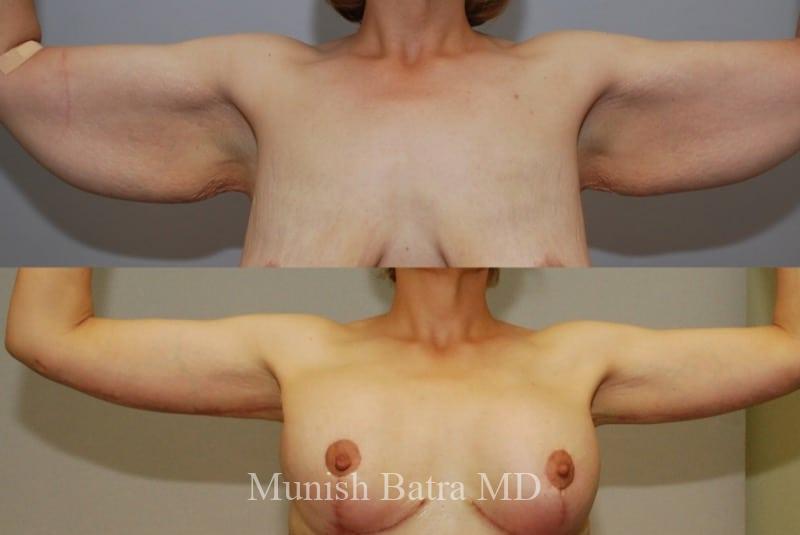 Before and After Image