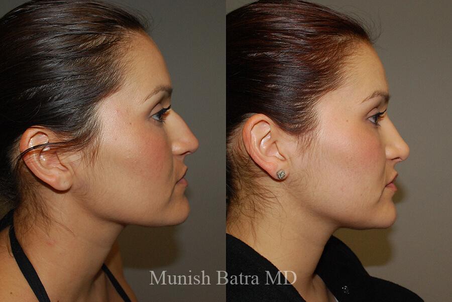 Before and After Image