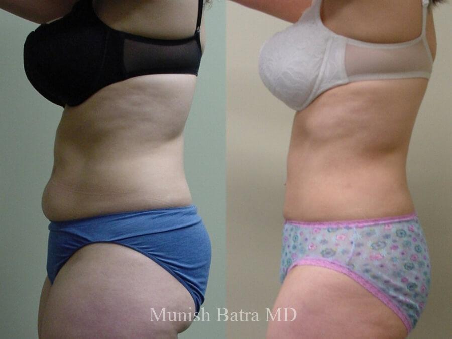 Before and After Image