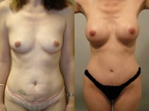 Before and After Image