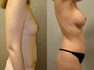 Before and After Image