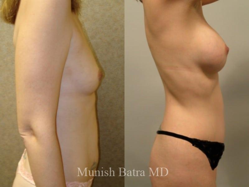 Before and After Image