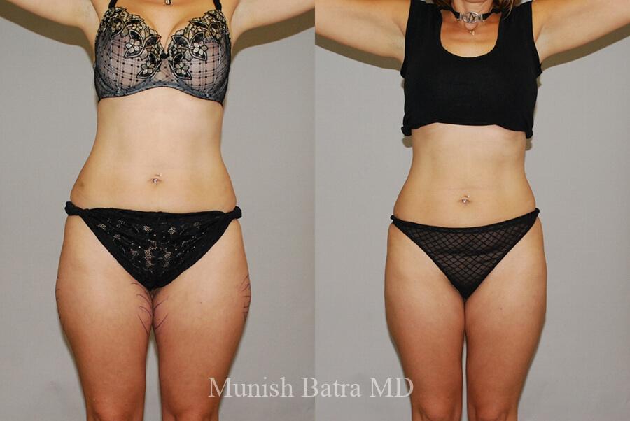 Before and After Image