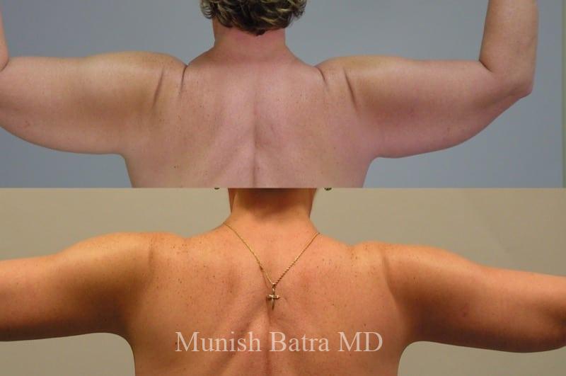 Before and After Image