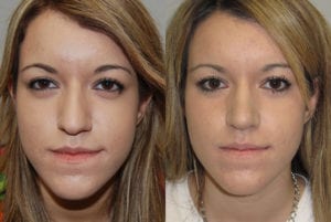 Before and After Image